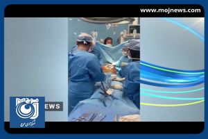 دستاورد جدید متخصصان کشور در پیوند اعضا + فیلم