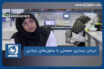 درمان بیماری مفصلی با سلول‌های بنیادی
