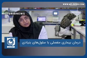 درمان بیماری مفصلی با سلول‌های بنیادی