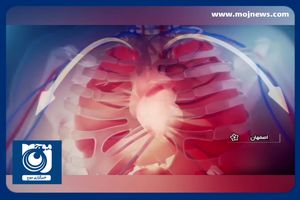 بومی‌سازی دستگاه پیشرفته گردش خون + فیلم